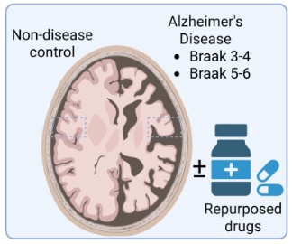 The Synaptic Proteome with Disease Progression